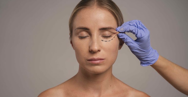 Close-up of a woman undergoing aesthetic procedure preparation with pre-surgery markings near the eye, representing cosmetic transition after stopping dermal fillers