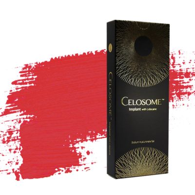 Celosome Implant