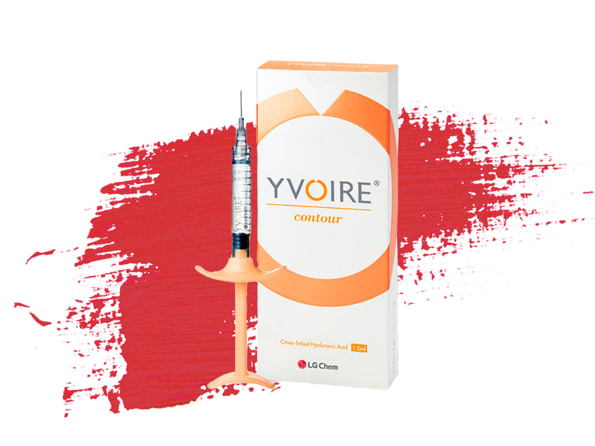 Yvoire Contour