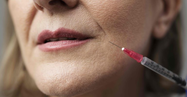 Close-up of a dermal filler or botulinum toxin injection targeting the nasolabial fold area to smooth deep wrinkles – featured in Toxifillers.com educational blog.