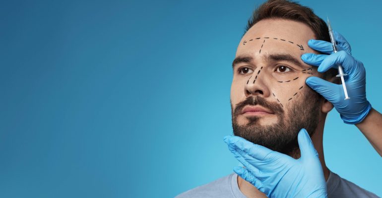 Male patient during cosmetic filler consultation with facial markings, guided by an aesthetic practitioner in blue gloves