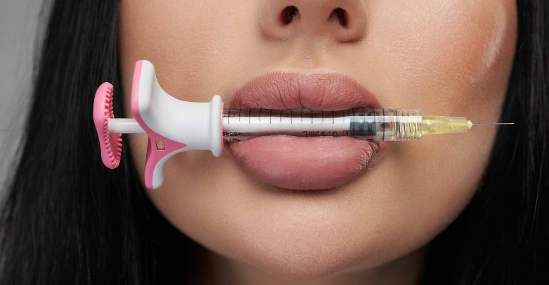 Close-up of plump lips with a syringe for hyaluronic acid filler injection – aesthetic medicine and lip augmentation.